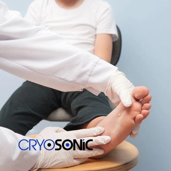 Are you looking for fast effective wart removal Contact us today Durham