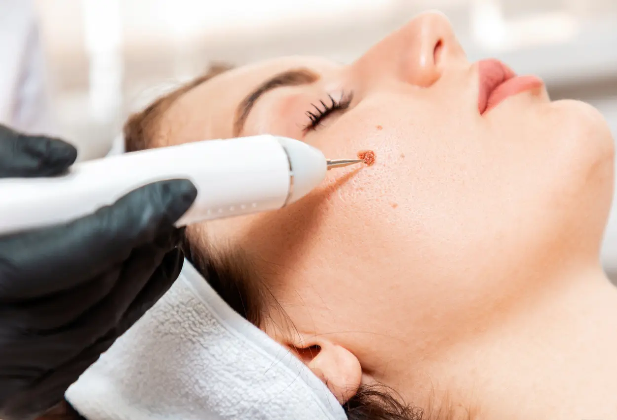 Frequently Asked Questions About Multiple Cryotherapy Treatments Durham